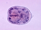 Estado larvario (protoescólex)., por CDC Public Health Image Library